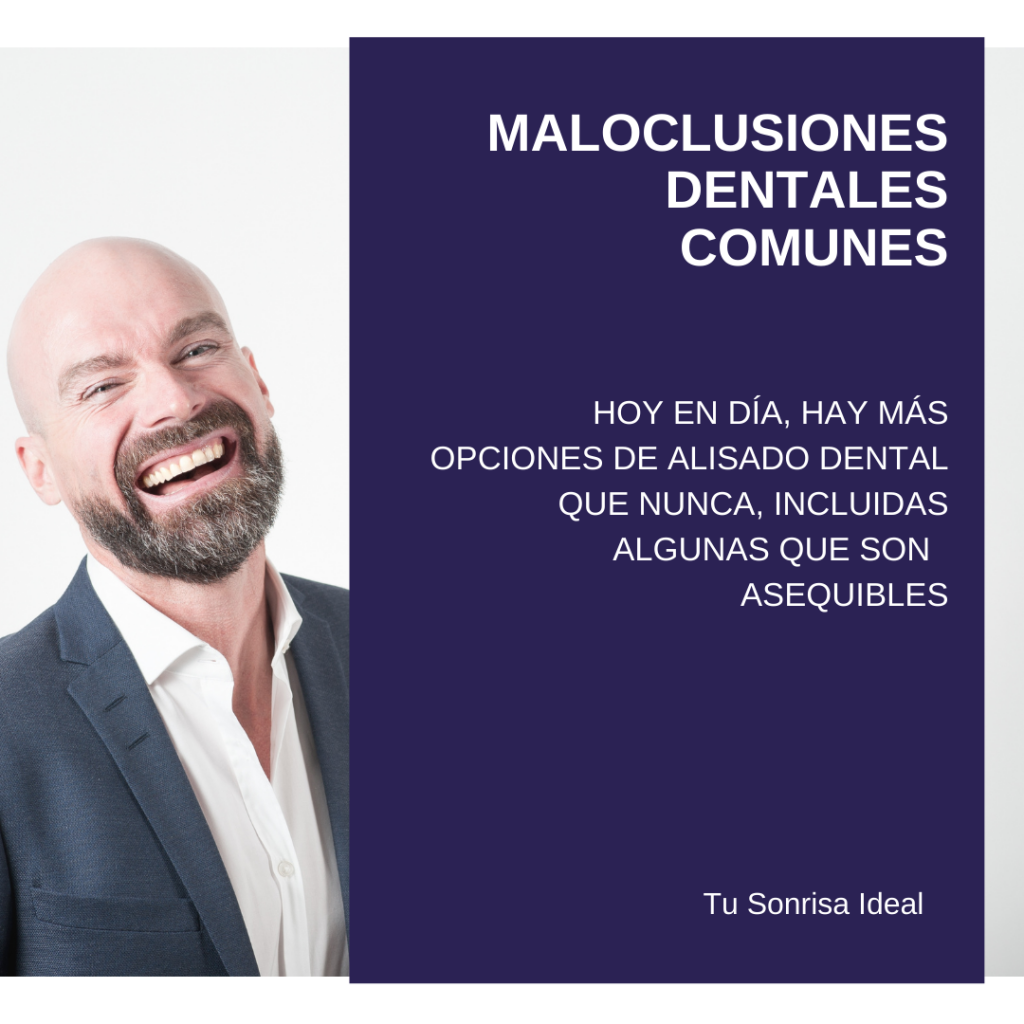 Maloclusiones dentales comunes: Tratamientos adecuados