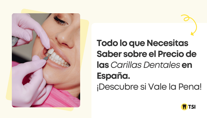 Precio de las carillas dentales