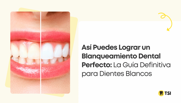 asi puedes lograr un blanqueamiento dental perfecto