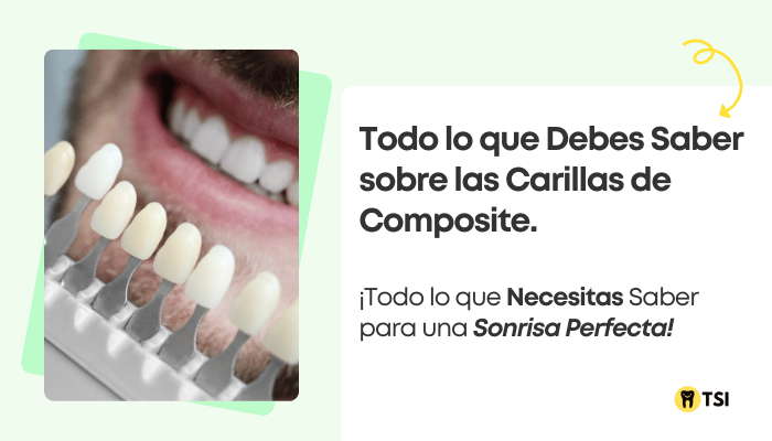 Carillas Dentales de Composite: Guía sobre las ventajas, desventajas y Precios