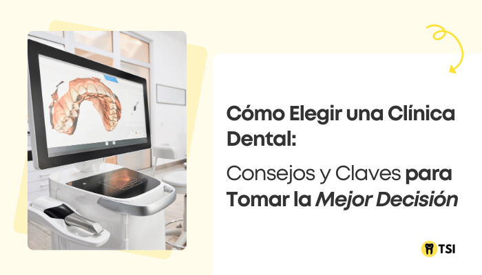 ¿Cómo elegir una buena clínica dental? Consejos a tener en cuenta para elegir la mejor opción