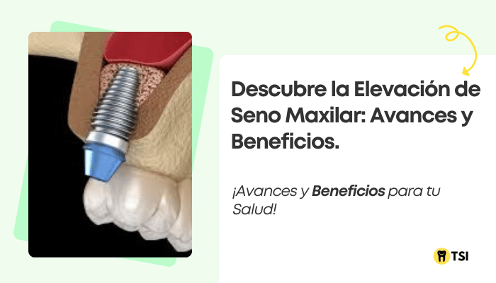 descubre la elevacion de seno maxilar avances y beneficios