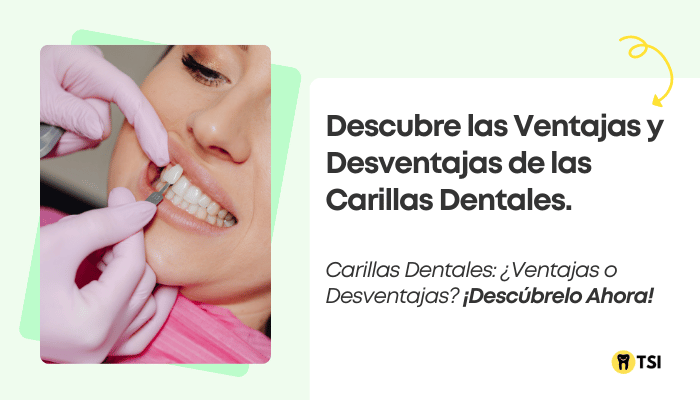 ¿Qué Son las Carillas Dentales? Ventajas, Desventajas y Precios