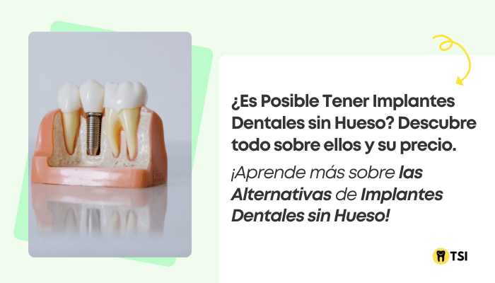 es posible tener implantes dentales sin hueso