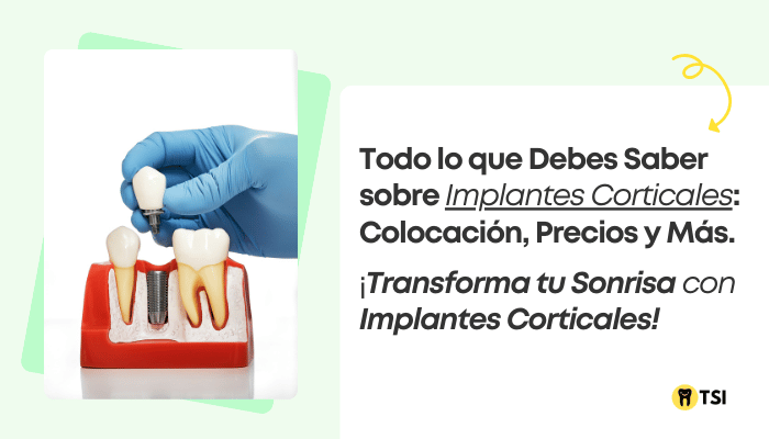 Implantes Corticales: Todo lo que necesitas saber acerca de este tratamiento 