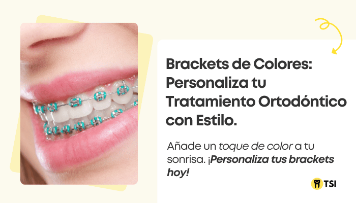 brackets de colores personaliza tu tratamiento ortodontico con estilo