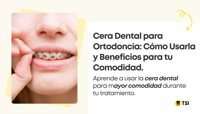 cera dental para ortodoncia como usarla y beneficios para tu comodidad