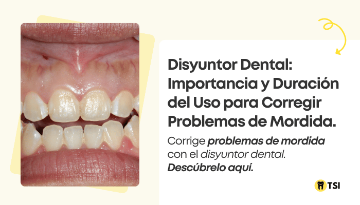 disyuntor dental importacia y duracion del uso para corregir problemas de mordida