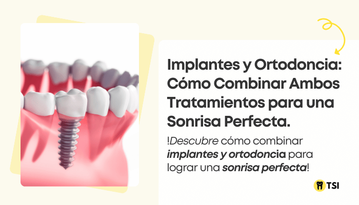 implantes y ortodoncia como combinar ambos tratamientos para una sonrisa perfecta