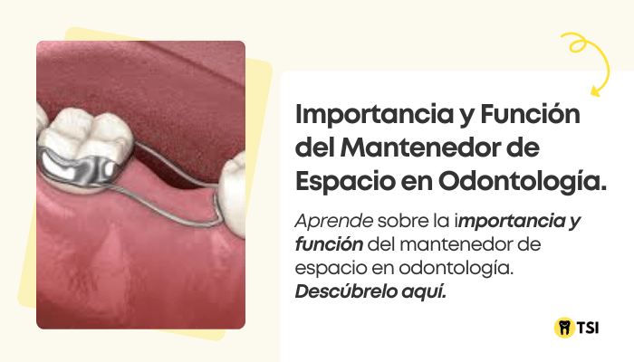 importancia y funcion del mantenedor de espacio en odontologia