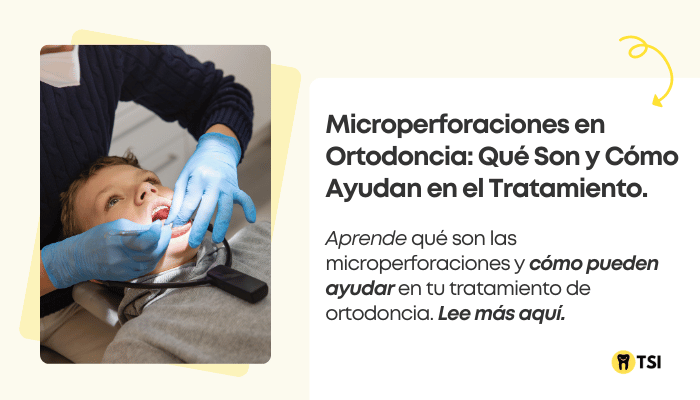 microperforaciones en ortodoncia que son y como ayudan en el tratamiento