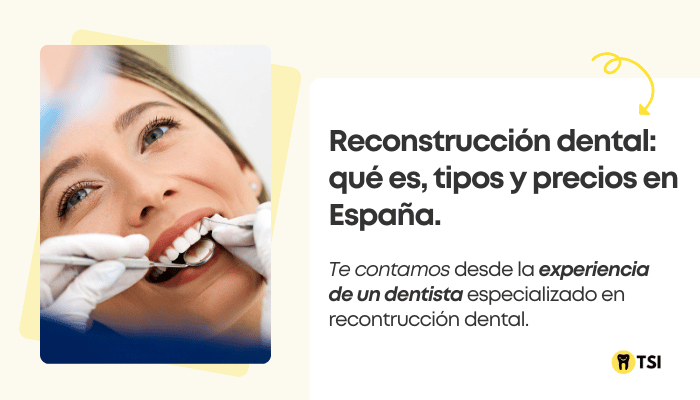 reconstruccion dental