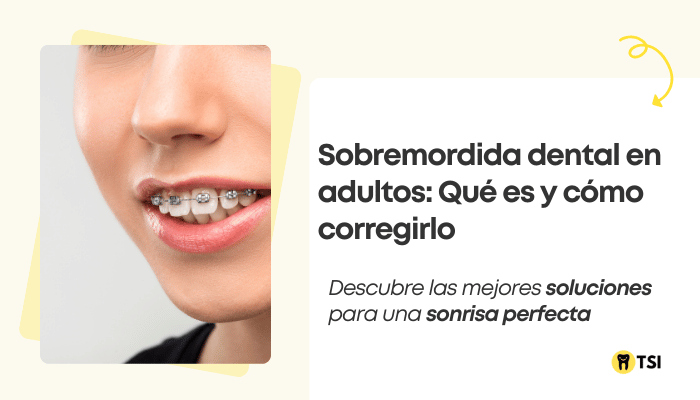 Sobremordida dental en adultos: Qué es y cómo corregirlo