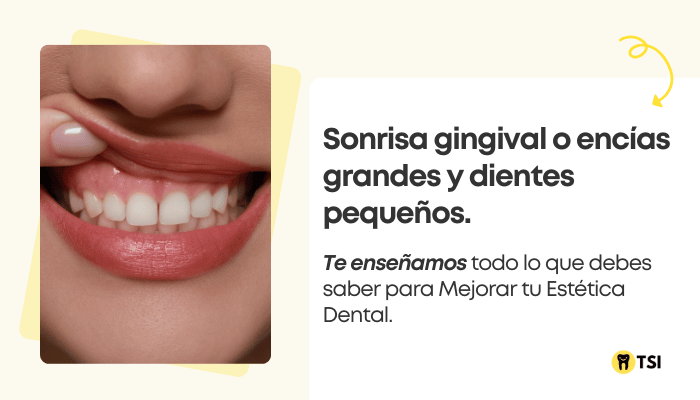 Sonrisa gingival: Todo lo que necesitas saber sobre las encías visibles