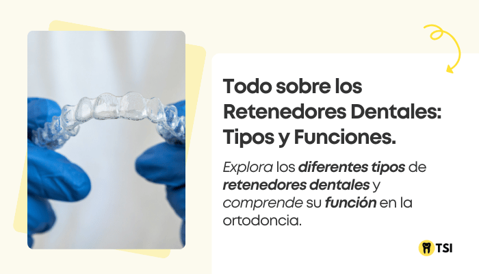 todo sobre los retenedores dentales tipos y funciones