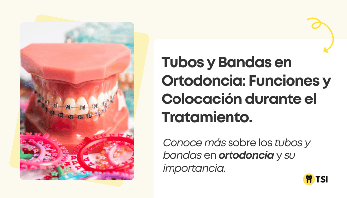 tubos y bandas en ortodoncia funciones y conocacion durante el tatamiento