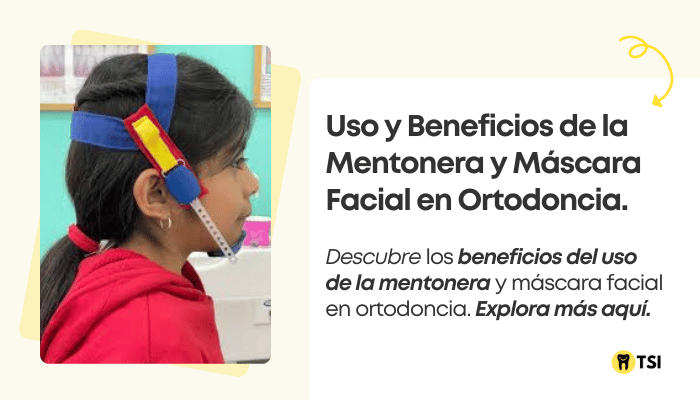 uso y beneficios de la mentonera y mascara facial en ortodoncia